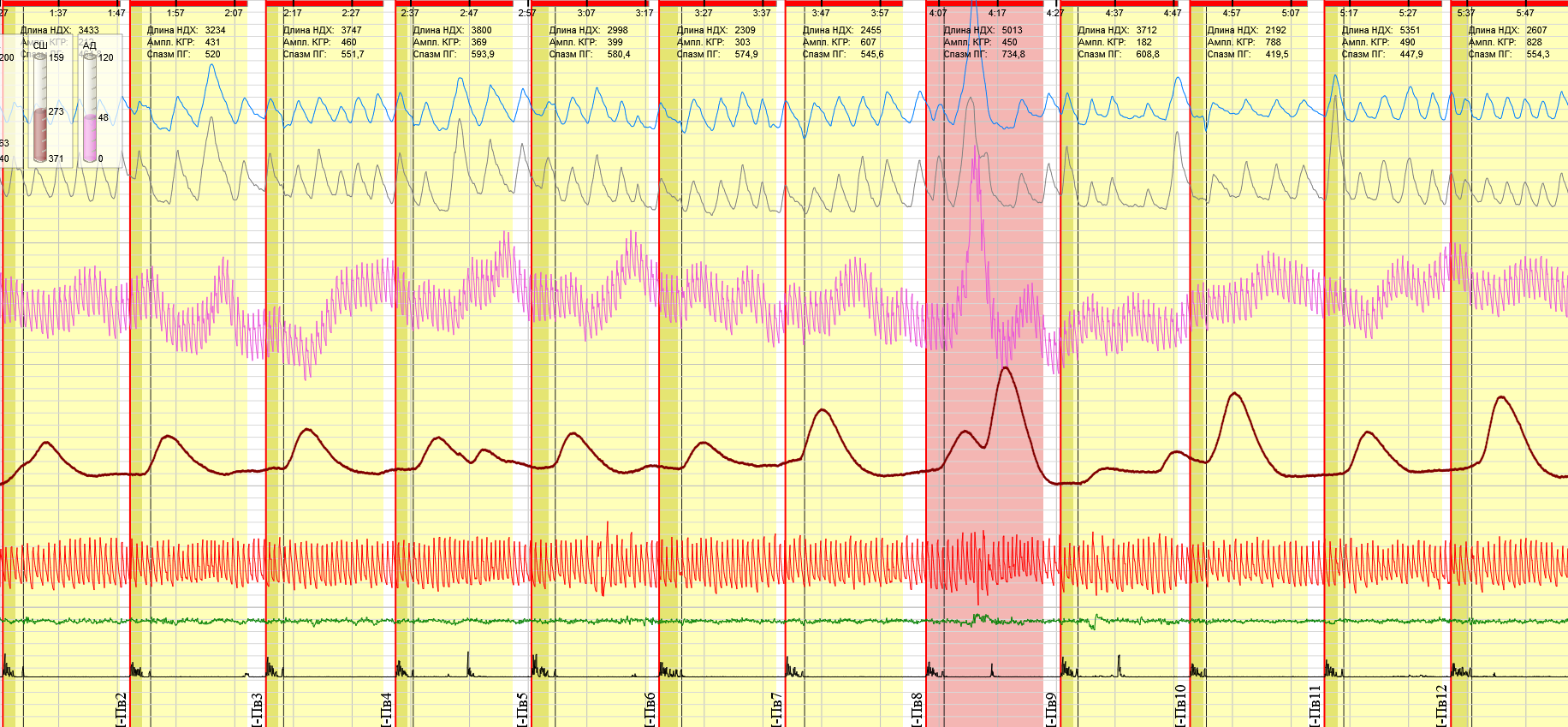 Поисковый ряд 3 повтор 1